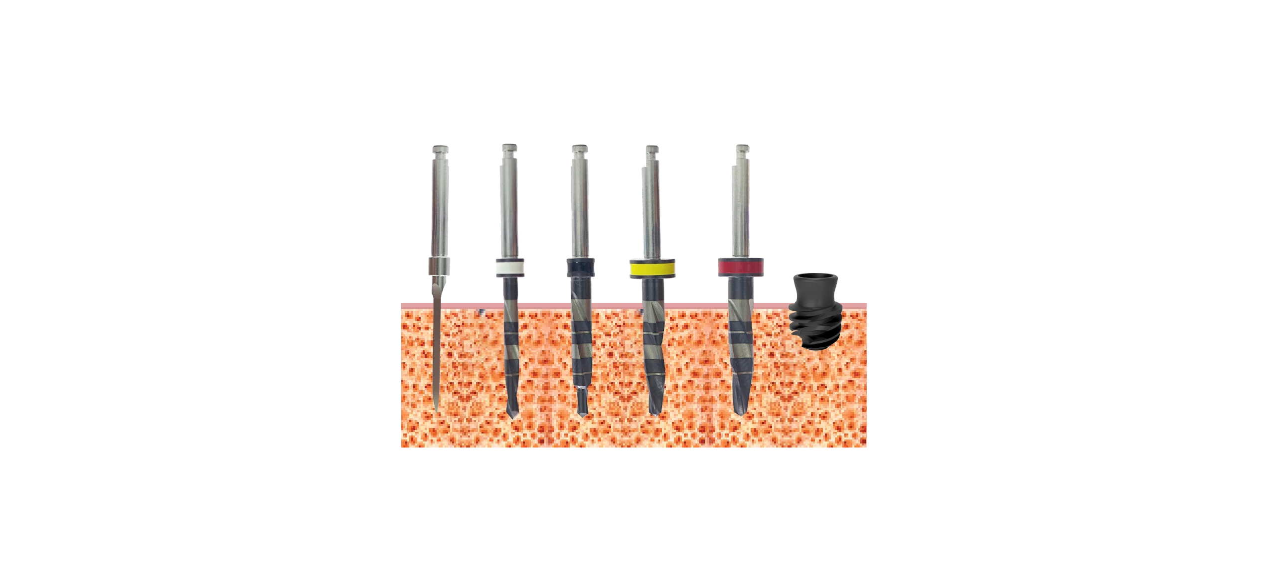 Drill sequence, implants 3.5mm, Bone type I, II
