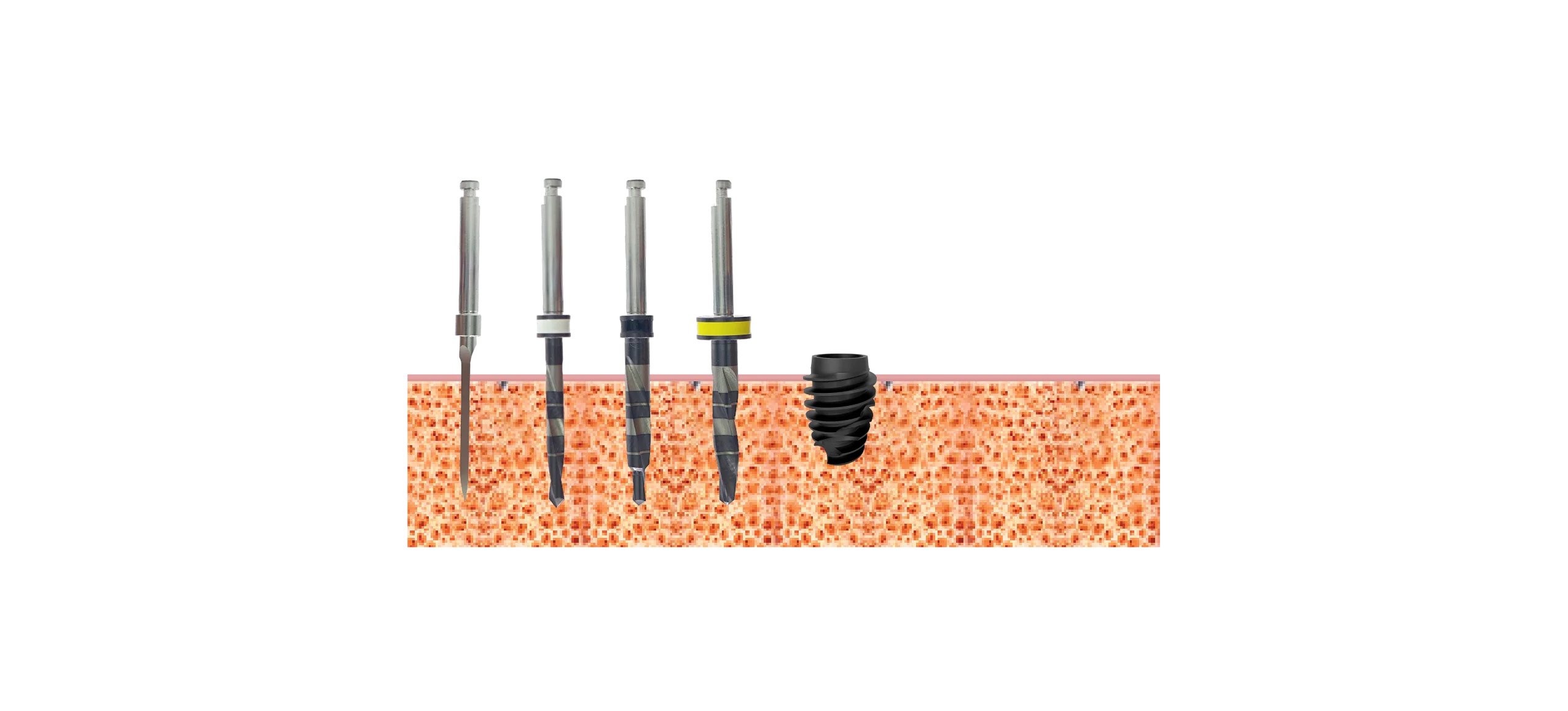 Drill sequence, implants 3.5mm, Bone type III, IV