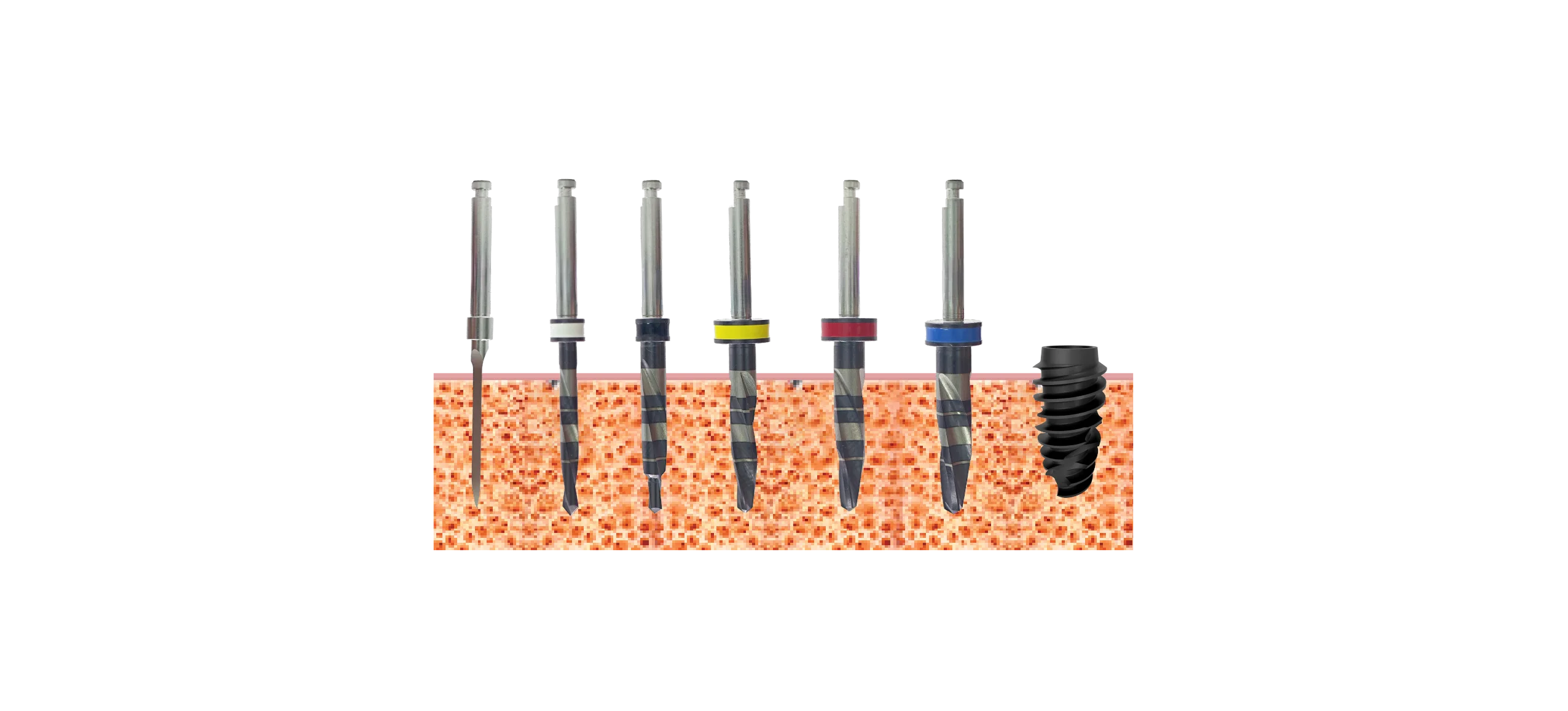 Drill sequence, implants 4.5mm, Bone type I, II