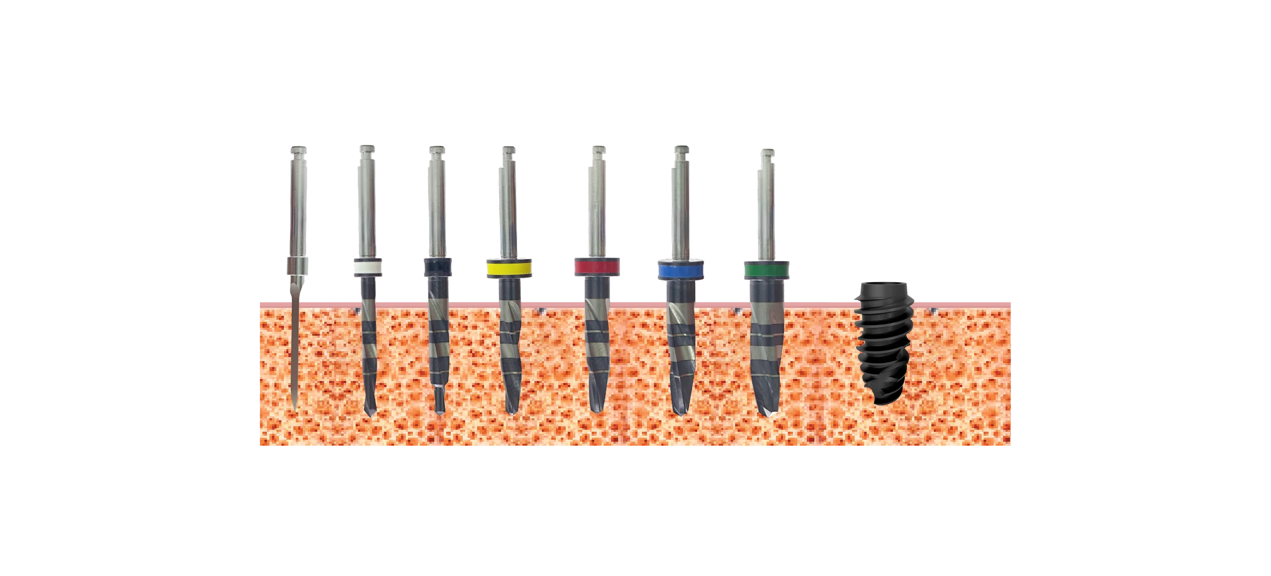 Drill sequence, implants 5.5mm, Bone type I, II, III