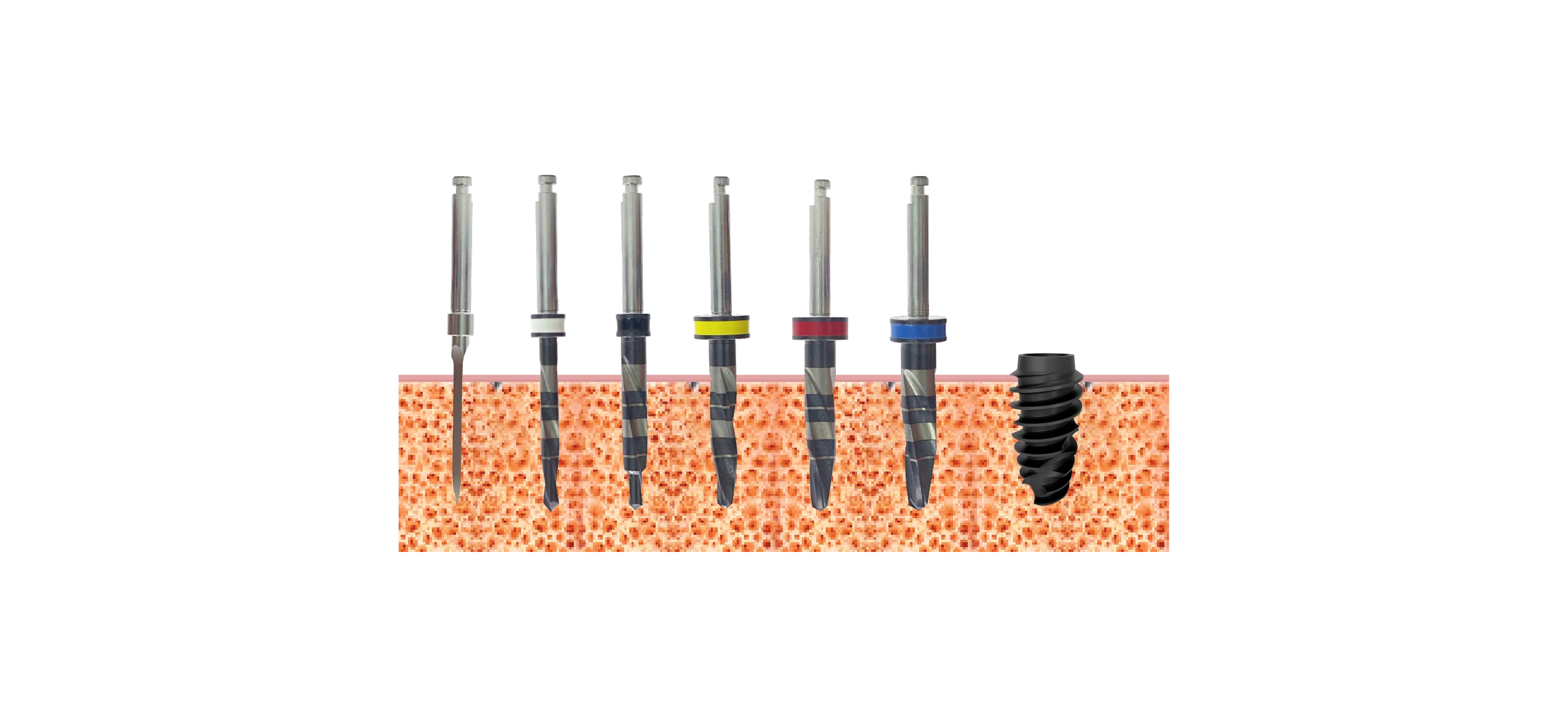 Drill sequence, implants 5.5mm, Bone type IV